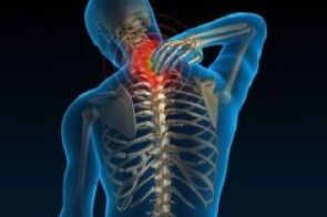 Cervical osteocondrosis leads to tenderness in the neck