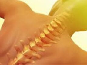 Osteochondrosis - back disease