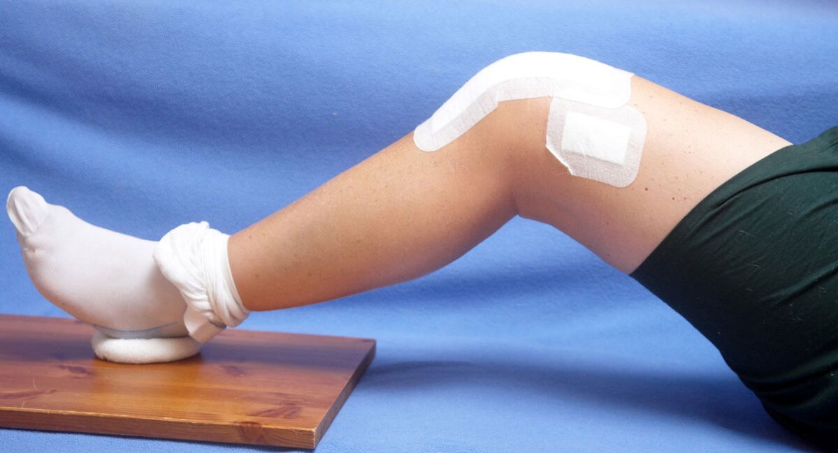 arthrosis in the treatment of the knee joint